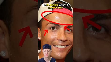 Did Ronaldo Get Plastic Surgery? Exploring the Rumors and Realities